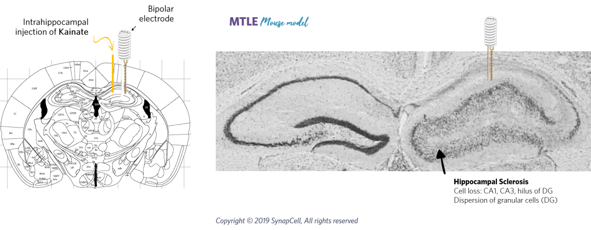 HPD-cell-loss-synapcell-In-vivo-efficacy-Testing-on-CNS-disorders