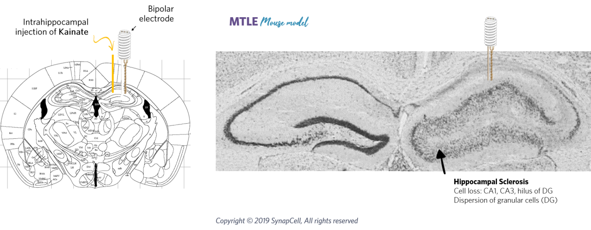 HPD-cell-loss-synapcell-In-vivo-efficacy-Testing-on-CNS-disorders