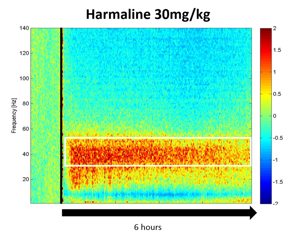 Essential-tremor-SynapCell-Harmaline-30-condition