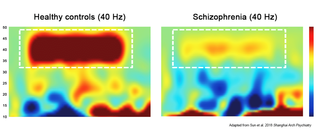 zhou-et-al-ASSR