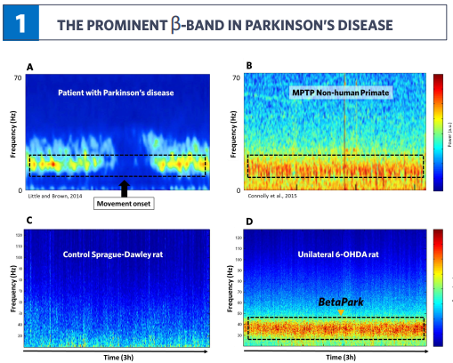 Synapcell And Motac Neuroscience Discover New Biomarker Of Parkinson S Disease Progression