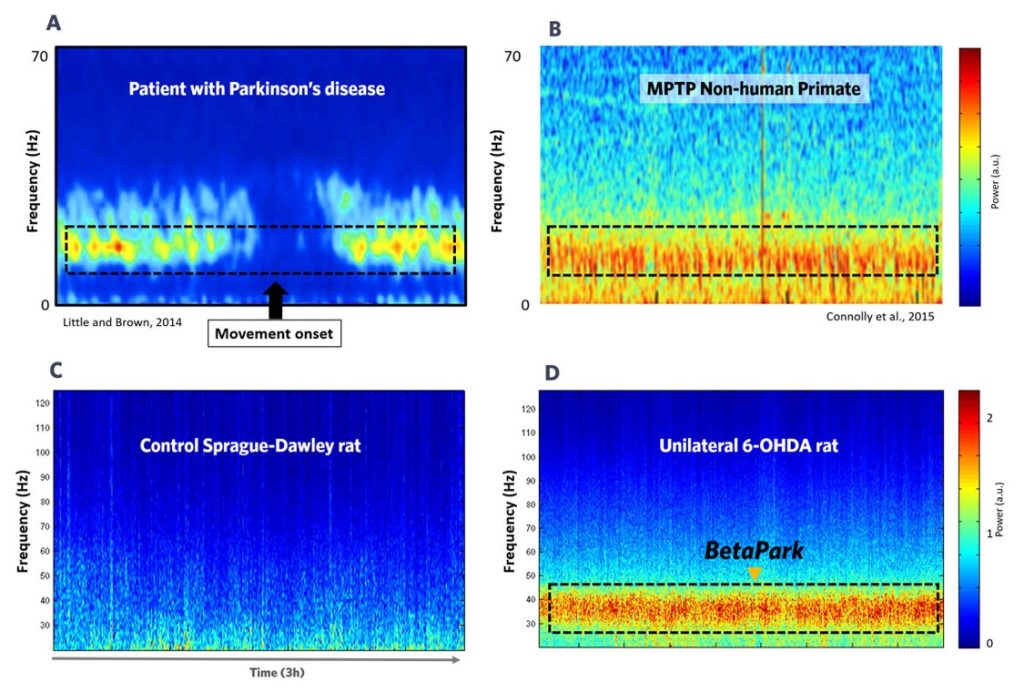 preclinical-CRO-EEG-parkinson