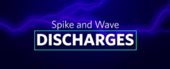 Spike-and-wave-discharges-synapcell-In-vivo-efficacy-Testing-on-CNS-disorders