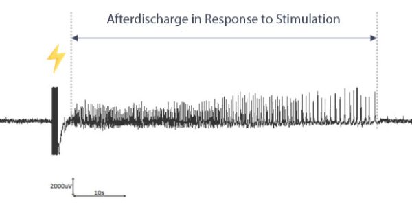 preclinical-CRO-EEG-epilepsy-Kindling